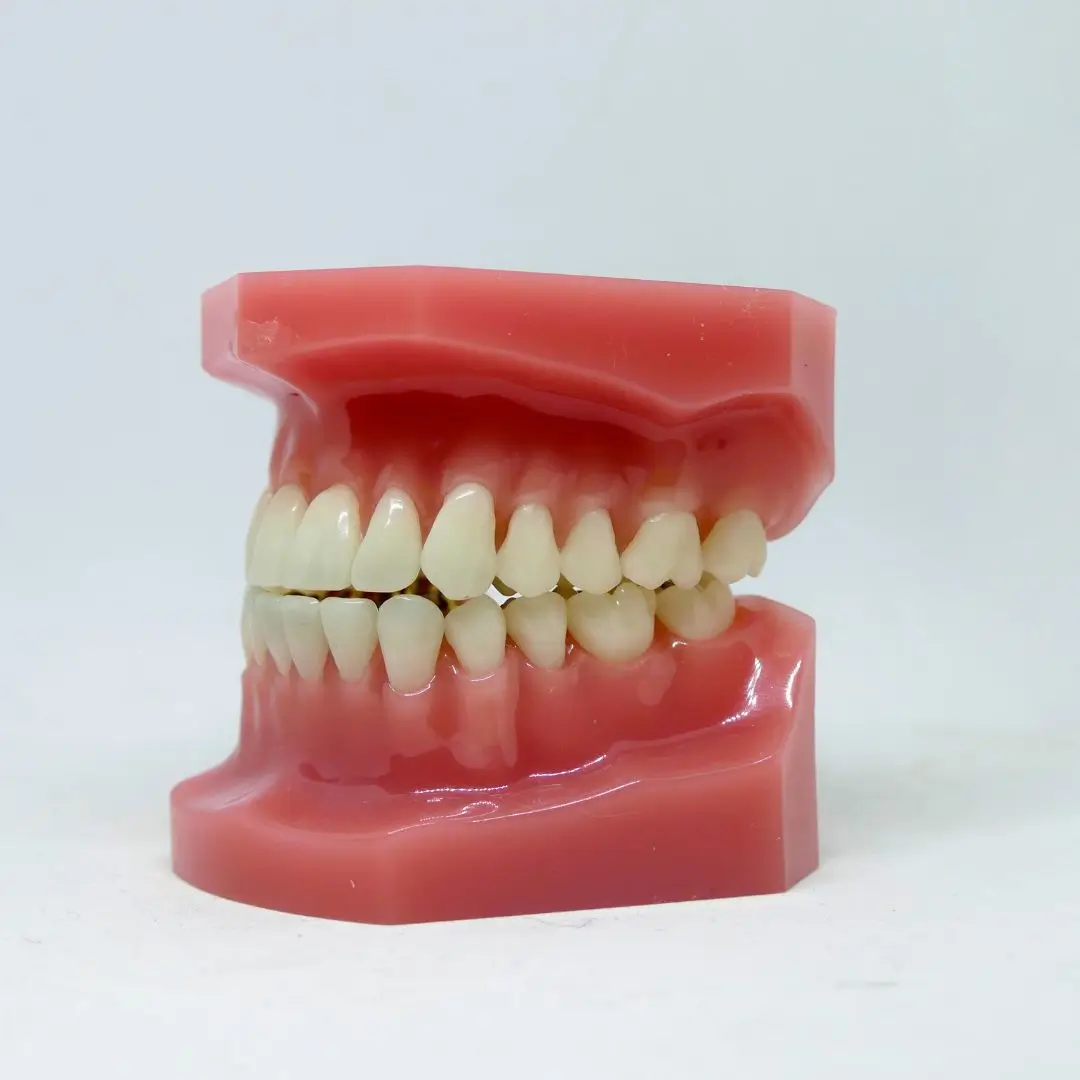 Causes of Gum Disease