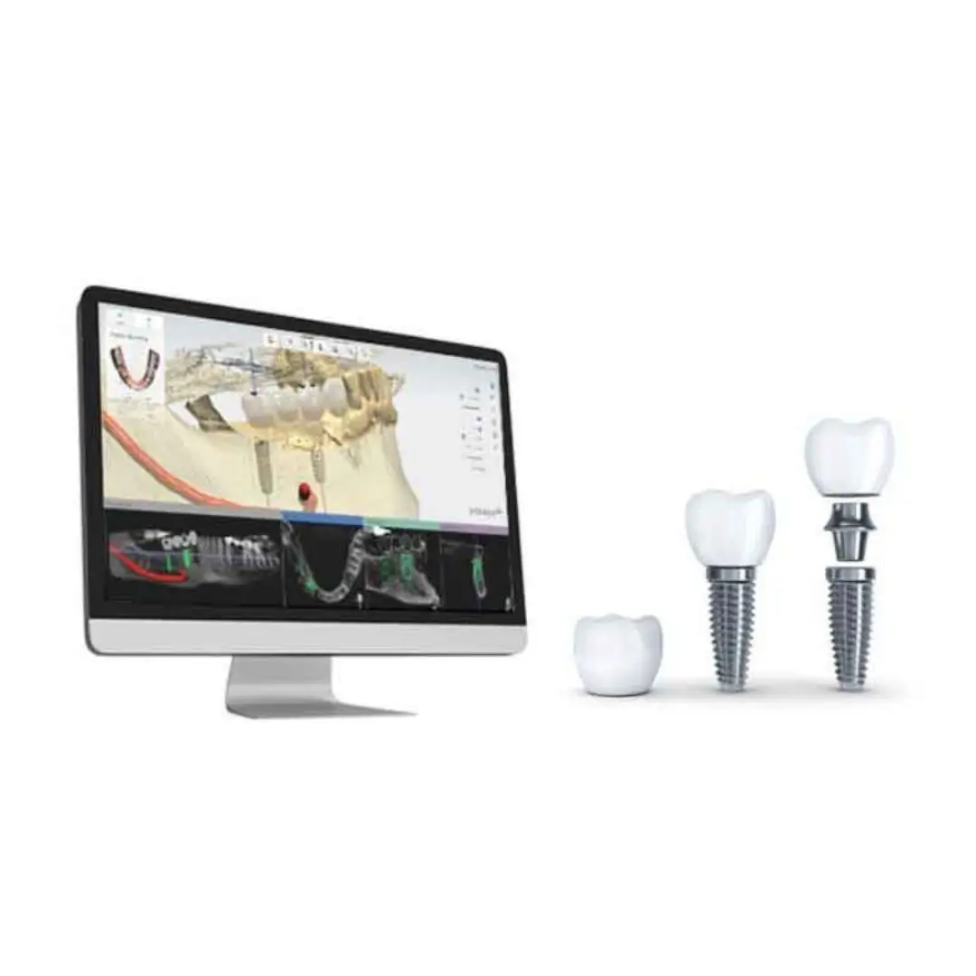 Computer Aided 3D Technology Based Dental Implants Essendon