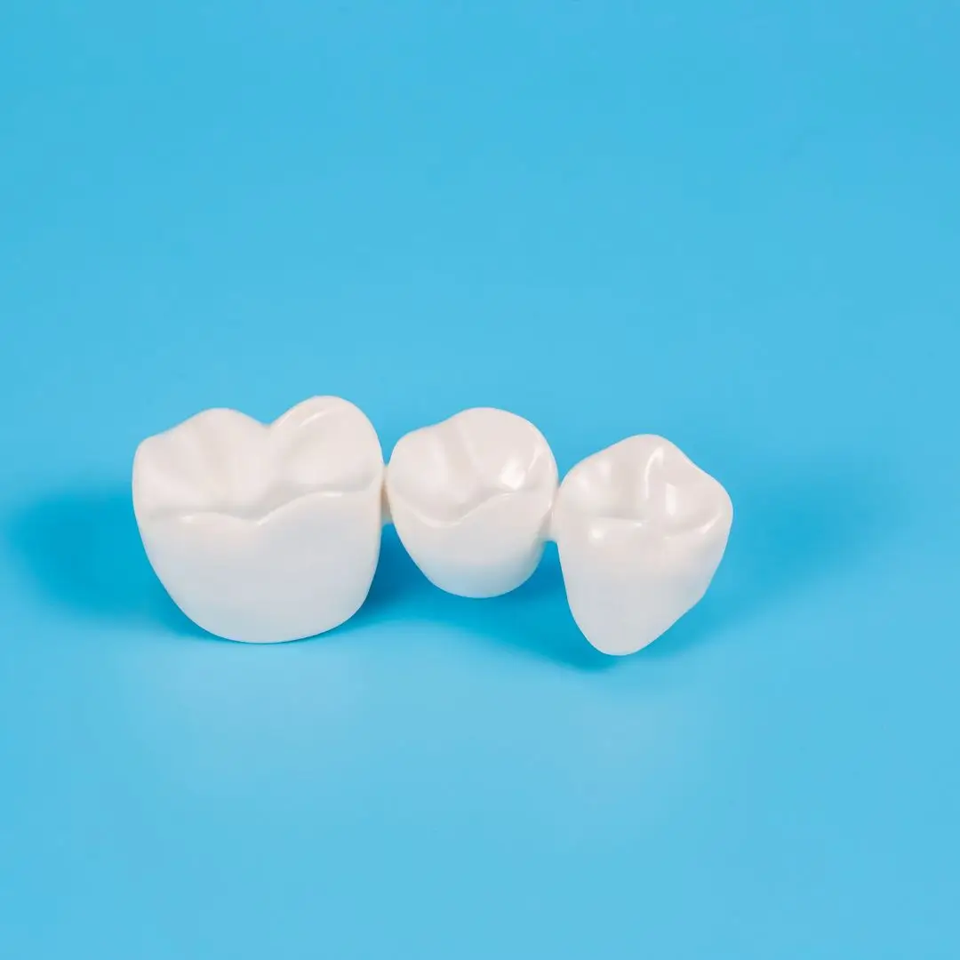 Dental Bridges and Crown