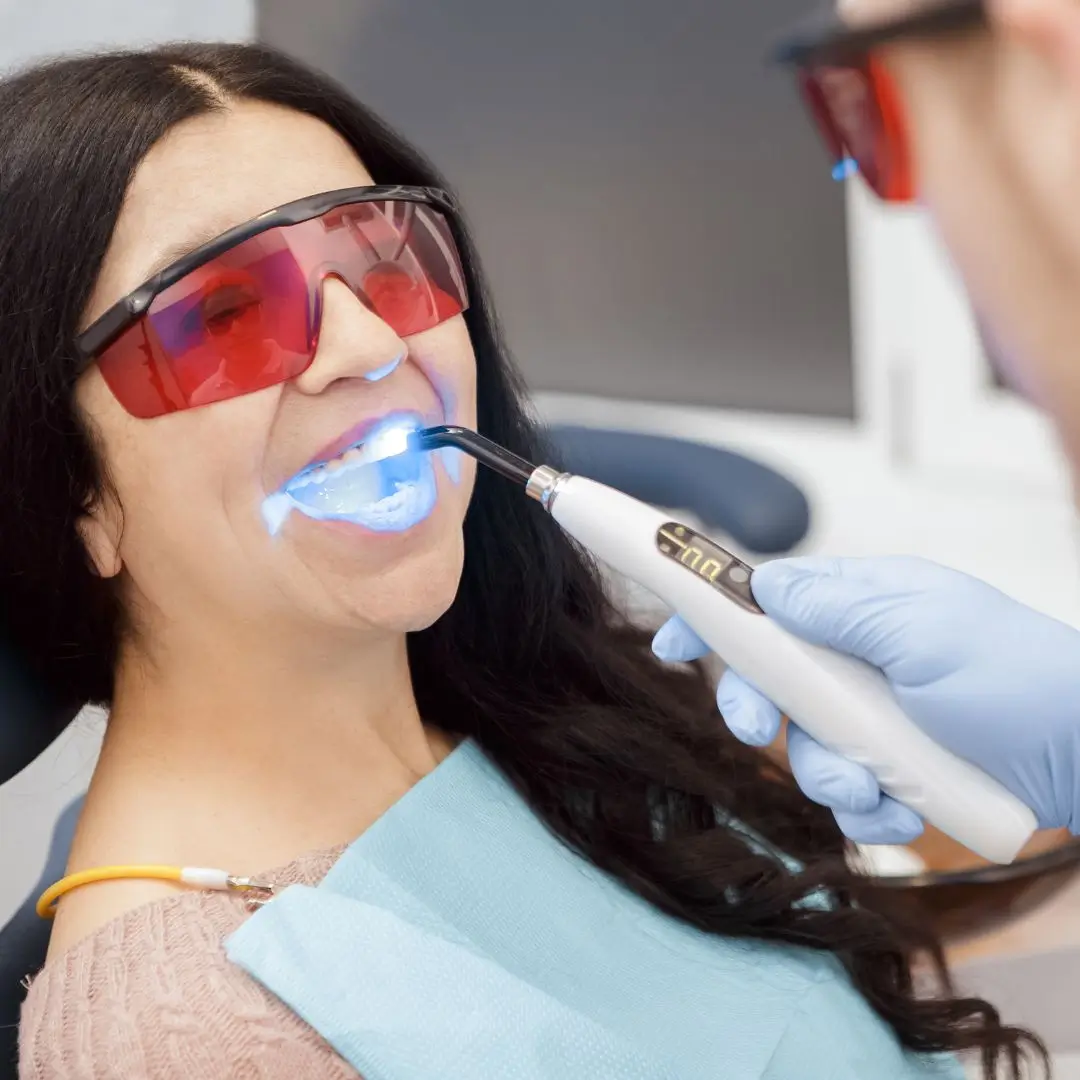 Dental Fillings Dentist Essendon