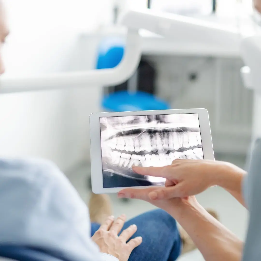 Dental Radiographs Dentist Essendon
