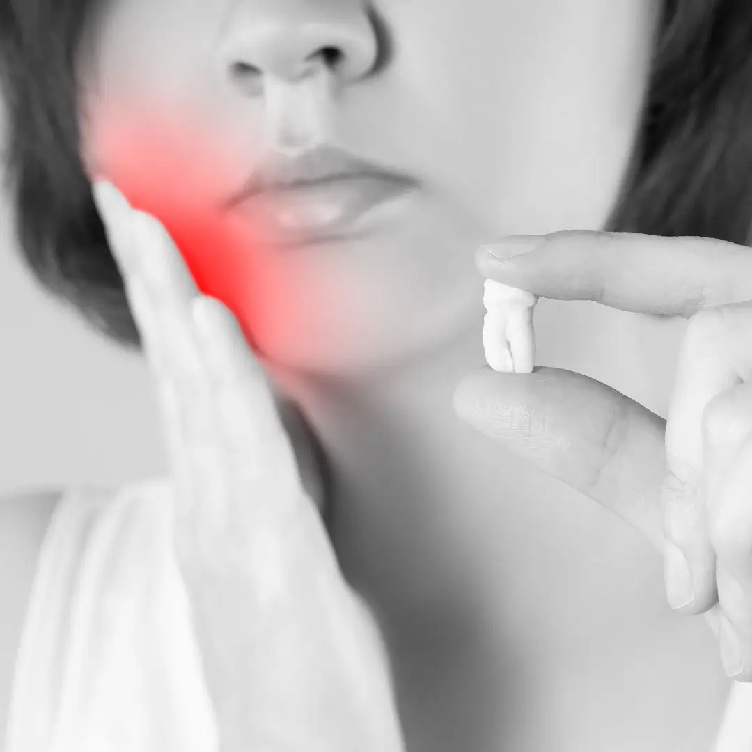 Removal of Wisdom Tooth