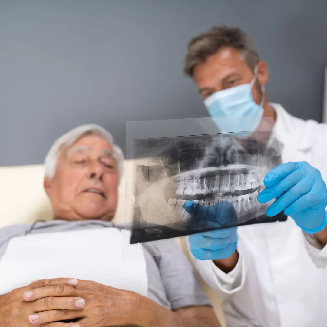 Step 3 X RAYS