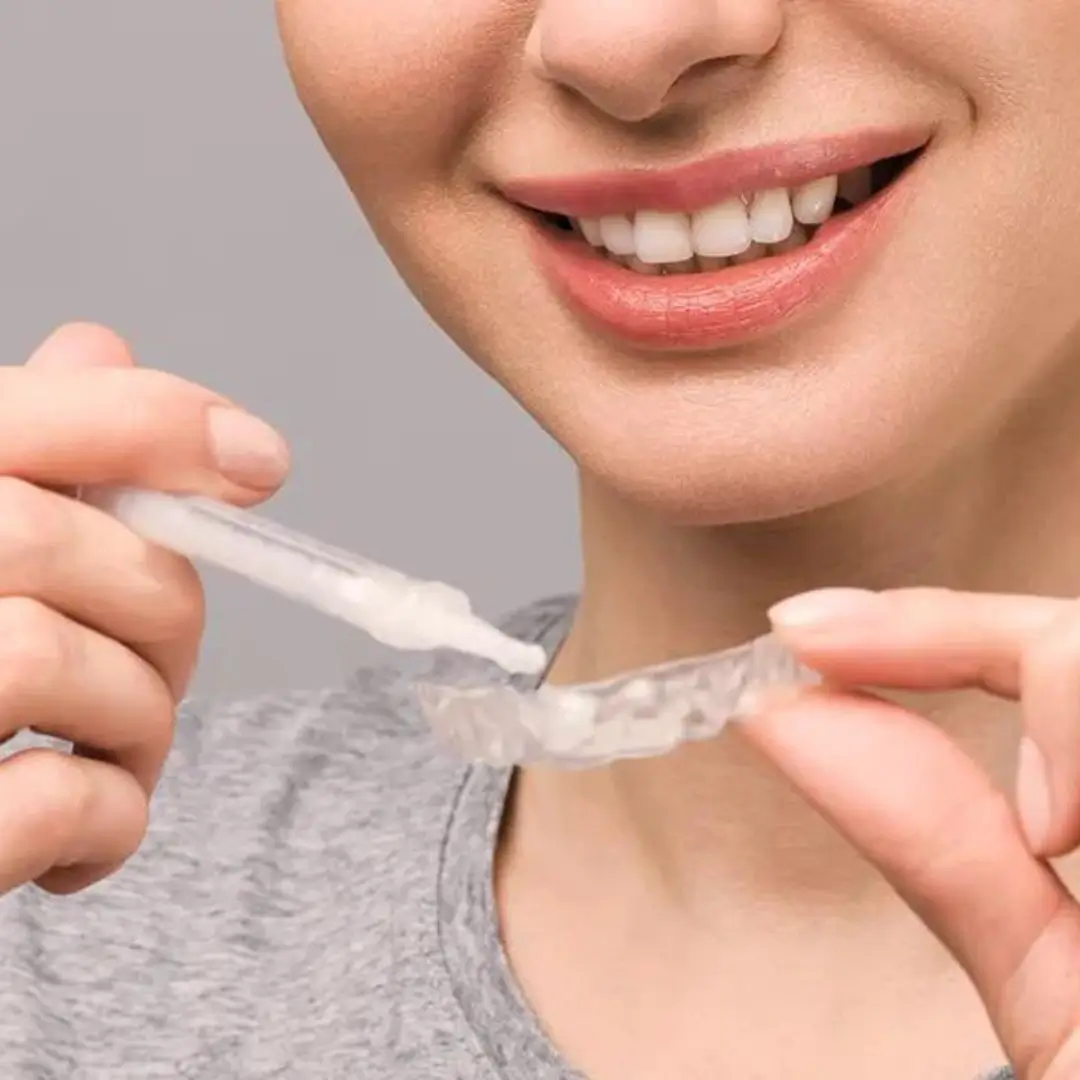 Take home teeth whitening Dentist Essendon