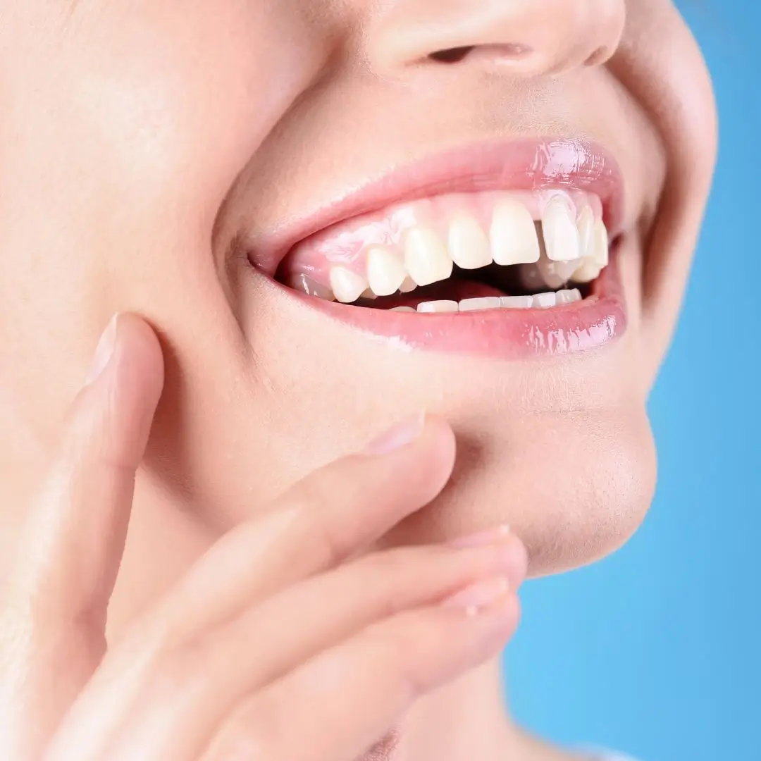 Teeth Spacing