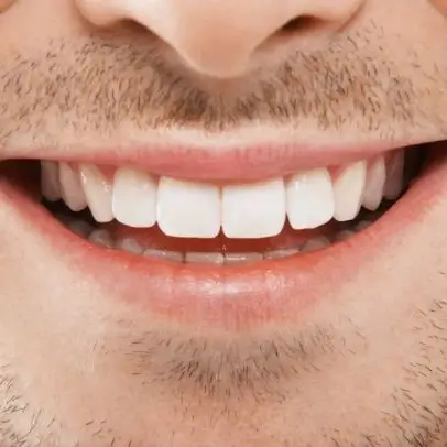 Advantages of Dental Porcelain