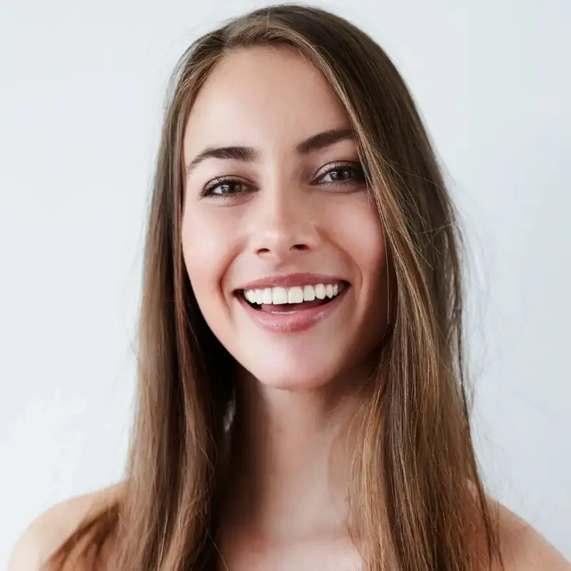 Do Composite Veneers in Essendon Appear Like Natural Teeth