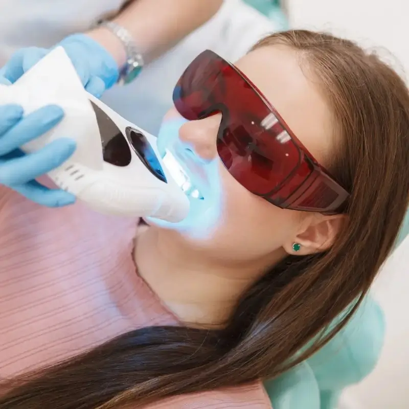 What is the Process of Teeth Whitening at Essendon Dentist
